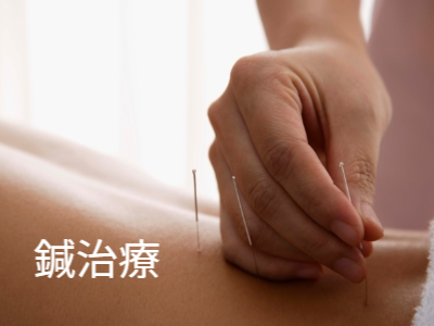 腰に鍼を打つ